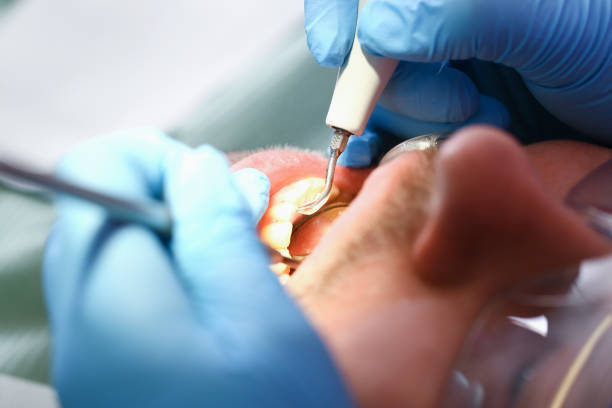 Best Emergency Broken Tooth Repair in Lake Helen, FL